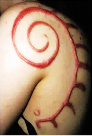 Rợn người với mốt xăm lột da của giới trẻ