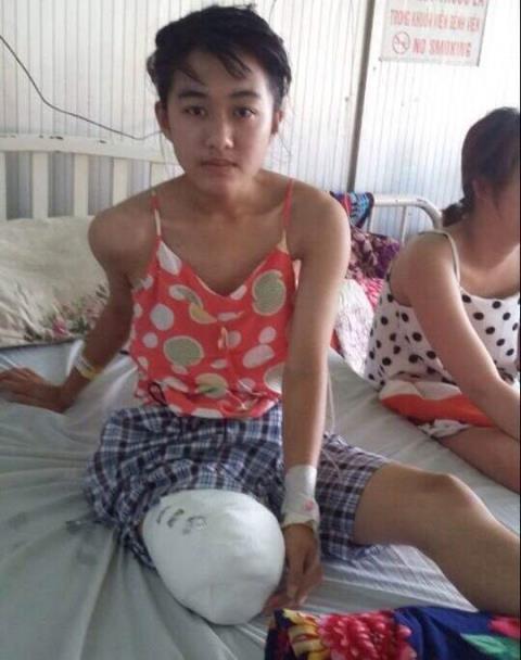 Nữ sinh mất chân do bệnh viện: Ôm lợi chỉ... dân thiệt - 0 Nữ sinh mất chân do bệnh viện: Ôm lợi chỉ... dân thiệt - 0