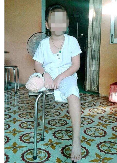 Nữ sinh mất chân do bệnh viện: Ôm lợi chỉ... dân thiệt - 1 Nữ sinh mất chân do bệnh viện: Ôm lợi chỉ... dân thiệt - 1