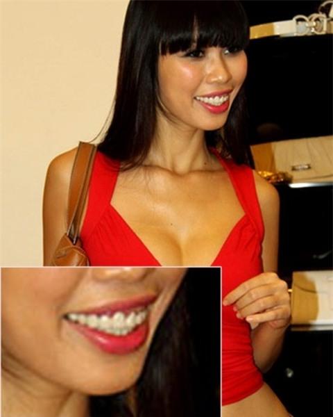 Những điểm xấu không thể phẫu thuật được của các sao nữ Việt - 8 Những điểm xấu không thể phẫu thuật được của các sao nữ Việt - 8