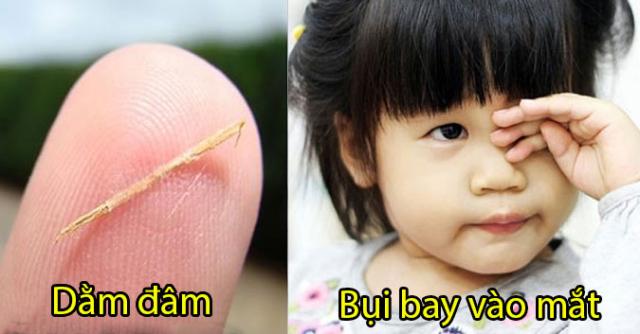 10 mẹo dân gian chữa dứt ngay bệnh vặt người Việt vẫn dùng hàng trăm năm qua