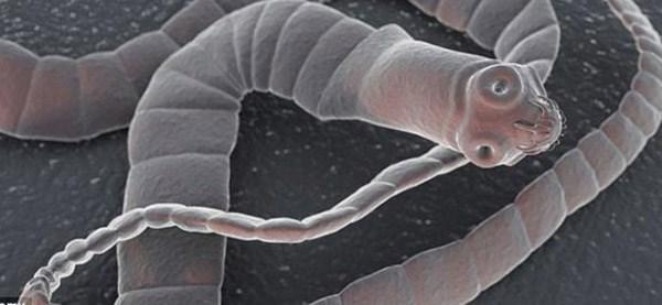 Nhiễm giun s&aacute;n khi ăn sushi: B&aacute;c sĩ khuyến c&aacute;o những nguy cơ tiềm ẩn - 1