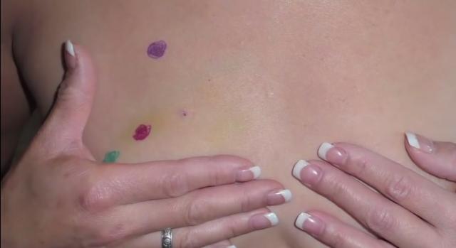 Cô gái mắc ung thư vì lý do không ai ngờ đến, ai đang dùng điện thoại cần lưu tâm - 3 Cô gái mắc ung thư vì lý do không ai ngờ đến, ai đang dùng điện thoại cần lưu tâm - 3