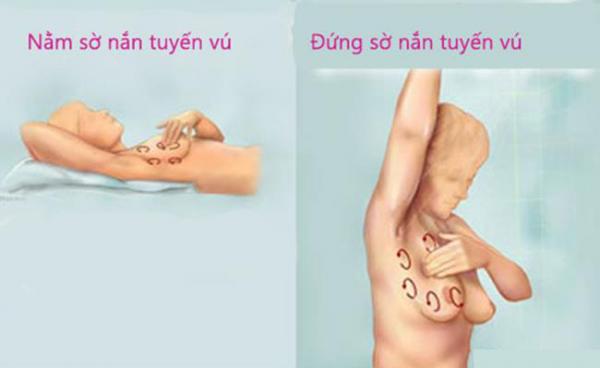 Cảnh báo của Giám đốc BV K trung ương: Khi có dấu hiệu sau, 80% là đã mắc ung thư vú - 2 Cảnh báo của Giám đốc BV K trung ương: Khi có dấu hiệu sau, 80% là đã mắc ung thư vú - 2