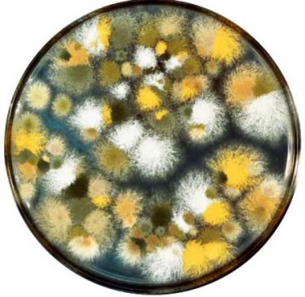 Độc tố ‘số 1’ nào gây ung thư gan có nhiều trong món ăn yêu thích ngày Tết? - 1 Độc tố ‘số 1’ nào gây ung thư gan có nhiều trong món ăn yêu thích ngày Tết? - 1