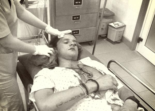 Khách Tây bị đánh vỡ đầu ở Hội An, khâu 11 mũi - 0 Khách Tây bị đánh vỡ đầu ở Hội An, khâu 11 mũi - 0