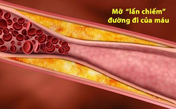 ‘Công thức vàng’ làm sạch mạch máu, giảm mỡ máu: Bài thuốc nên có trong mọi gia đình - 1 ‘Công thức vàng’ làm sạch mạch máu, giảm mỡ máu: Bài thuốc nên có trong mọi gia đình - 1