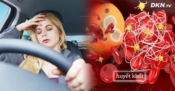 Tắc nghẽn mạch máu lặng lẽ mà nguy hiểm khôn lường, 5 kiểu người này rất dễ mắc phải - 0 Tắc nghẽn mạch máu lặng lẽ mà nguy hiểm khôn lường, 5 kiểu người này rất dễ mắc phải - 0