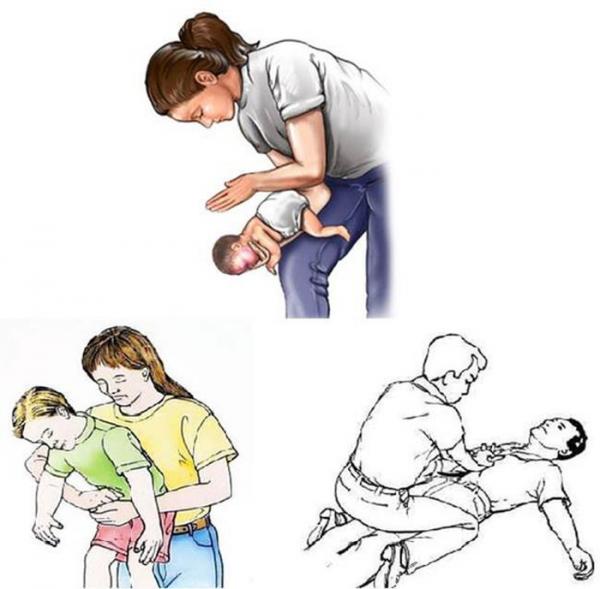15 bài sơ cứu khi bé bị gặp nạn, mẹ nhất định phải biết để cứu con kịp thời - 2 15 bài sơ cứu khi bé bị gặp nạn, mẹ nhất định phải biết để cứu con kịp thời - 2