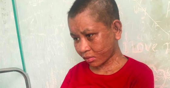 42 1 Vu An Rung Dong Nguoi Lam Thue Bi Chu Danh Dap Tra Tan Da Man O Gia Lai