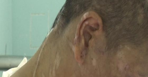 42 3 Vu An Rung Dong Nguoi Lam Thue Bi Chu Danh Dap Tra Tan Da Man O Gia Lai