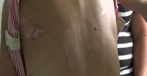 42 4 Vu An Rung Dong Nguoi Lam Thue Bi Chu Danh Dap Tra Tan Da Man O Gia Lai