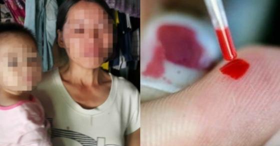 42 1 Viet Nam 42 Nguoi Trong Mot Huyen Duong Tinh Voi Hiv Benh Nhan Nho Nhat 18 Thang Lon Nhat 80 Tuoi