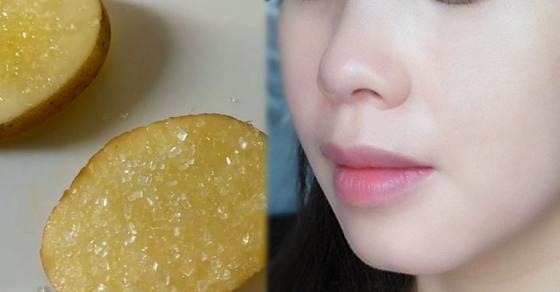 Chà lát khoai tây lên mặt 5 phút, 3 lần/tuần, tàn nhang, vết thâm mờ dần, da trắng bật tông