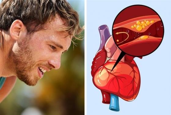 42 6 8 Nguyen Nhan Khien Ban Do Mo Hoi Nhieu