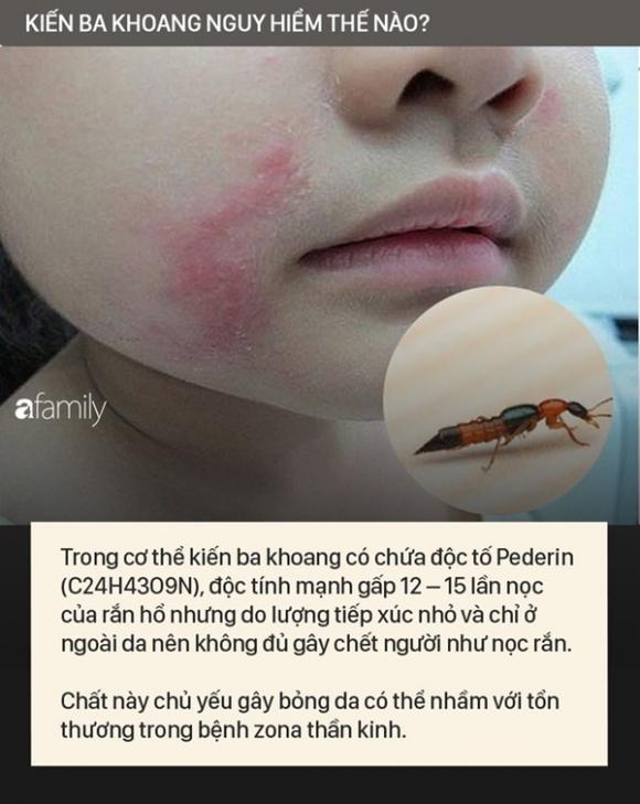 42 3 Doc To Cua Kien Ba Khoang Manh Gap 12 15 Lan Ran Ho Mang Nhan Biet Kien Ba Khoang Va Phong Tranh Chat Doc Cua Chung Dinh Vao Da