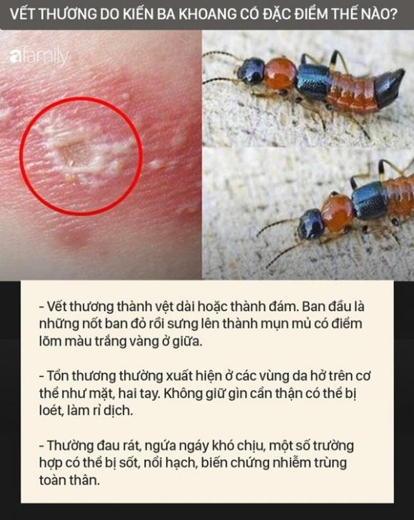 42 4 Doc To Cua Kien Ba Khoang Manh Gap 12 15 Lan Ran Ho Mang Nhan Biet Kien Ba Khoang Va Phong Tranh Chat Doc Cua Chung Dinh Vao Da