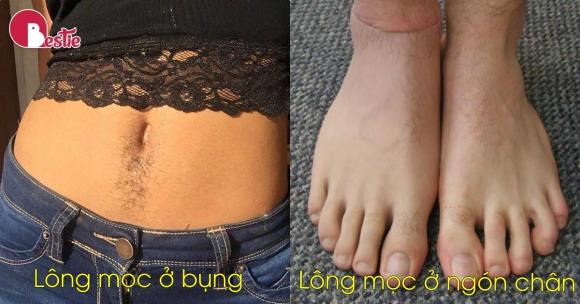 Nhân tướng học: Người có lông ở chân hoặc bụng thường rất giàu có