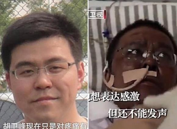 42 1 Bac Si Chuyen Mau Da Nau Vi Nhiem Ncov