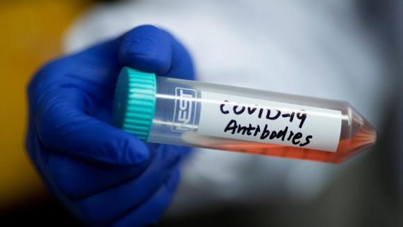 42 1 Chuyen Gia Lay Nhiem Khong Trieu Chung Diem Mau Chot Khien Covid 19 Lan Ra Toan Cau