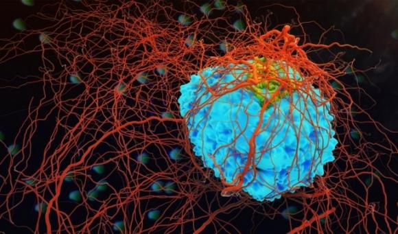 42 1 7 Loai Ung Thu Co Kha Nang Chua Khoi Neu Phat Hien Som