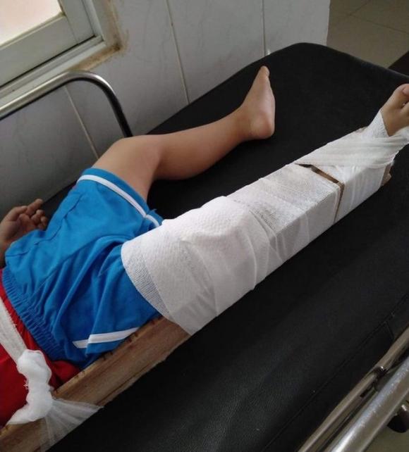 42 1 Thay Tre An Cham Co Giao Truong Mam Non Hoa My Dong Nai Doa Nat Bang Cach Gac Chan Em Len Co