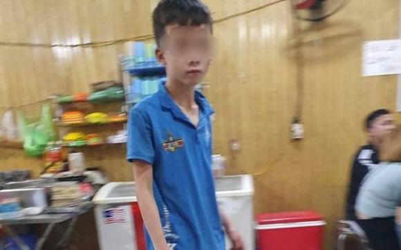 42 5 Nguoi Cha Bi Tam Than Va Gia Canh Ban Han Den Tham Thuong Cua Cau Be 15 Tuoi