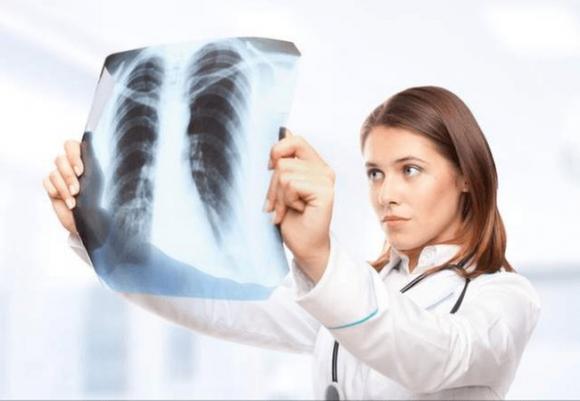 42 3 Chang Trai 23 Tuoi Khong Uong Ruou Khong Hut Thuoc Nhung Phoi Nhu Luoi Danh Ca Bac Si Canh Bao Thu Pham Nam Tren Tuong