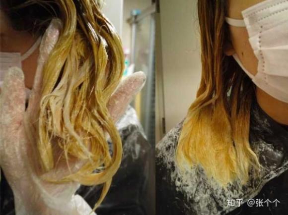 42 3 Nhuom Toc Lien Tuc 4 Lantuan Trong Thoi Gian Dai Mot Phu Nu Bi Viem Phoi Ke Va Phai Dung Thuoc Suot Doi