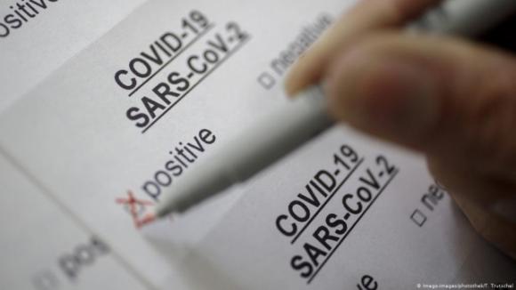 42 1 Europol Canh Bao Ve Tinh Trang Lam Gia Giay Xac Nhan Am Tinh Voi Sars Cov 2