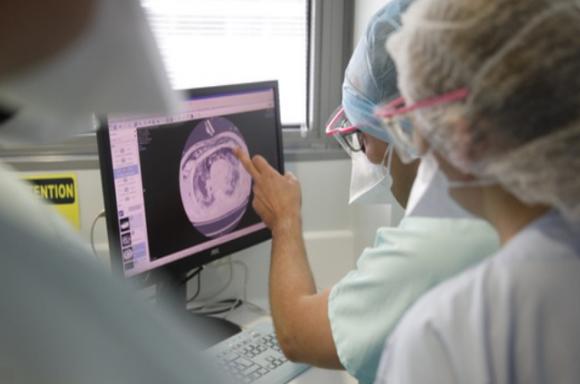 SARS-CoV-2 gây hại cho các tế bào phổi chỉ trong vài giờ như thế nào?