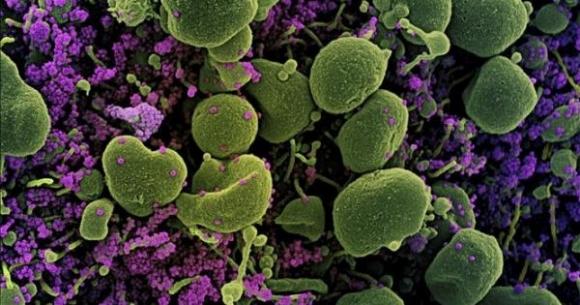 Thế giới hiện có 4.000 biến thể virus SARS-CoV-2