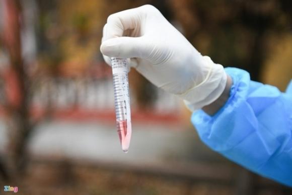 Những triệu chứng thường gặp của người nhiễm SARS-CoV-2 tại Việt Nam