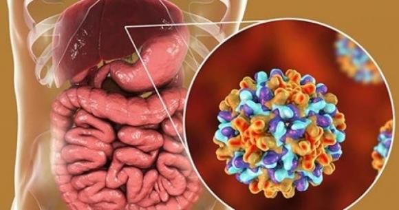 4 loại gia vị quen thuộc nhà nào cũng dùng được công nhận là ‘cao thủ đầu độc’ gan, bỏ ngay trước khi quá muộn