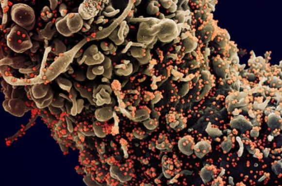 Phát hiện đột biến mới khiến SARS-CoV-2 tăng 8 lần khả năng lây nhiễm