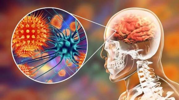 Cảnh báo một loại virus gây chết người gấp 75 lần virus Corona