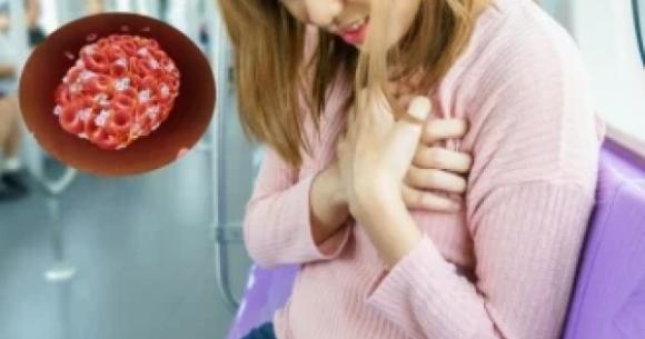 5 dấu hiệu cảnh báo cục máu đông trong cơ thể rất nguy hiểm, không ai được bỏ qua