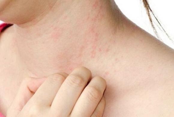 Cơ thể ngứa ngáy ở 2 bộ phận này cảnh báo gan bị bệnh, nên đi khám sớm kẻo hối hận không kịp