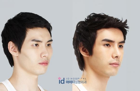 42 4 Cac Chang Trai Han Dep Hon Han Sau Khi Got Cam Nang Mi