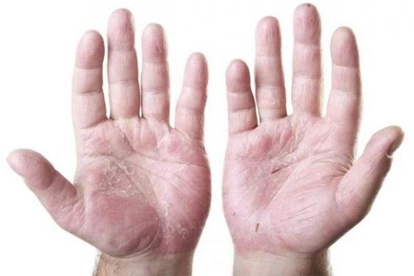 42 1 8 Dau Hieu Co The Keu Cuu Vi An Thieu Chat Rat Nhieu Nguoi An Sai Cach Gap Tinh Trang Nay