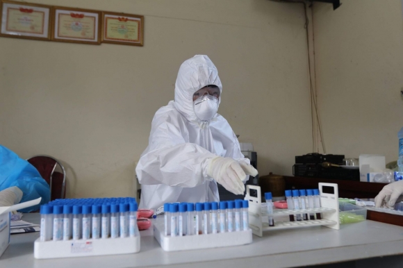 1 Ha Noi Ghi Nhan Them 11 Ca Duong Tinh Sars Cov 2