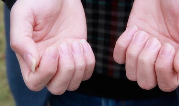 2 Nguoi Song Tho Thuong Co Du 8 Dac Diem Nay Tren Co The Neu Co Mot Vai Trong So Nay Thi Xin Chuc Mung Ban