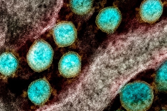 1 Phat Hien Sieu Khang The Chong Duoc 23 Bien Chung Ncov