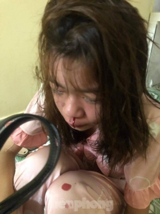 2 Nu Nhan Vien Quan Karaoke Bi Dong Nghiep Lot Quan Ao Bao Hanh Nhu Thoi Trung Co