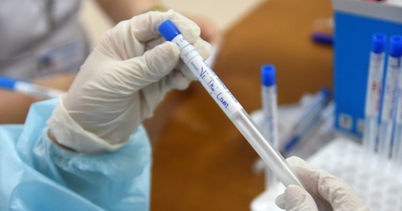 1 Co Ket Qua Test Nhanh Duong Tinh Tu Roi Benh Vien Ve Nha Tu Cach Ly