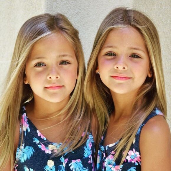 4 2 Chi Em Tung Duoc Menh Danh La Cap Song Sinh Xinh Dep Nhat The Gioi Duoc San Don Khi Moi 6 Thang Tuoi Bay Gio Ra Sao