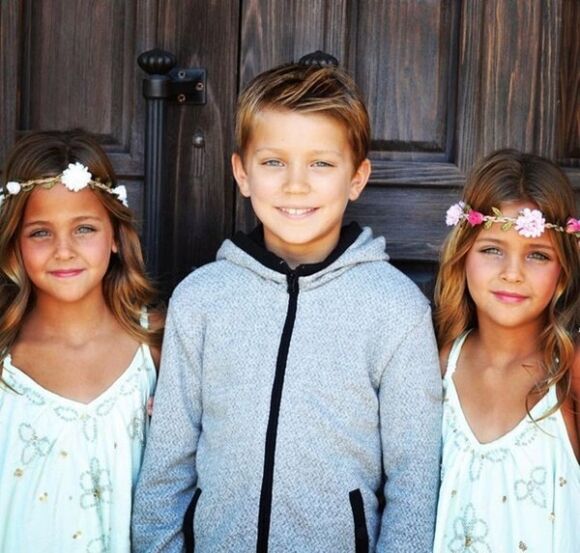 5 2 Chi Em Tung Duoc Menh Danh La Cap Song Sinh Xinh Dep Nhat The Gioi Duoc San Don Khi Moi 6 Thang Tuoi Bay Gio Ra Sao