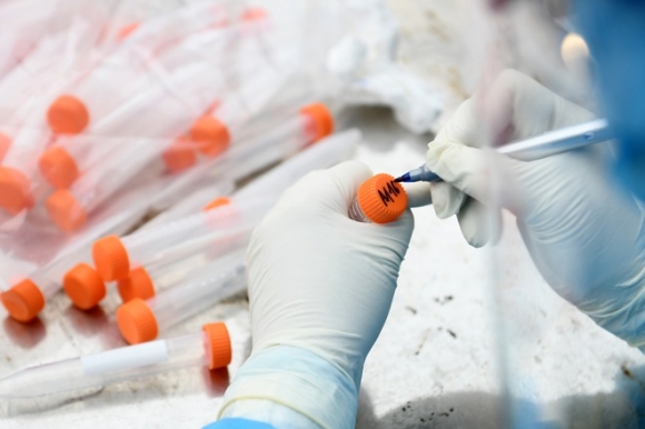 1 Ha Noi Du Kien Lay 65000 Mau Xet Nghiem Sars Cov 2 Trong Hom Nay