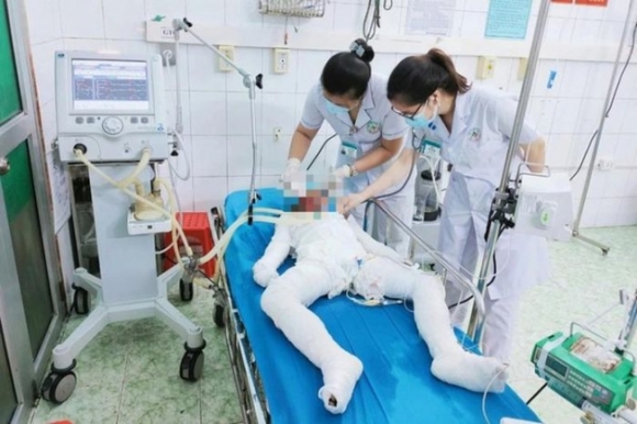 1 Nghi An Bo De Dung Xang Thieu 3 Con Nho Roi Tu Tu O Tuyen Quang