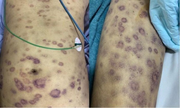 2 Tu Vong Vi An Hau Song